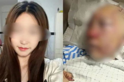 公厕被打女子:没有衣着暴露,公厕女子遭遇不公”